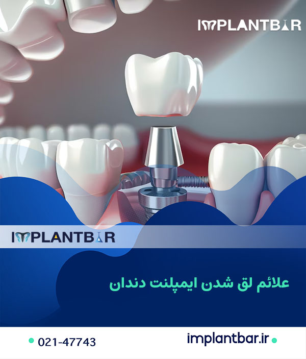 12-dental-implant-loosening13.jpg