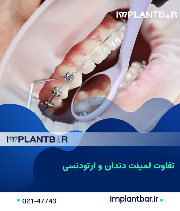 3-dental-laminate-or-orthodontics1.jpg