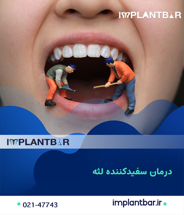 The-cause-of-black-gums-after-implant1.jpg