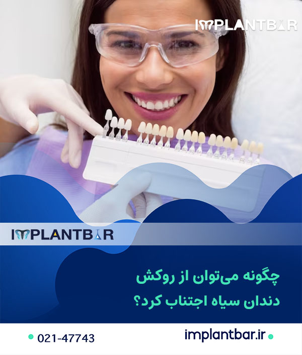 علل تیره شدن روکش‌ها