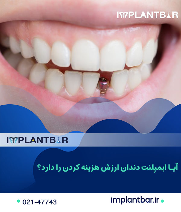 The-cost-of-dental-implants2.jpg