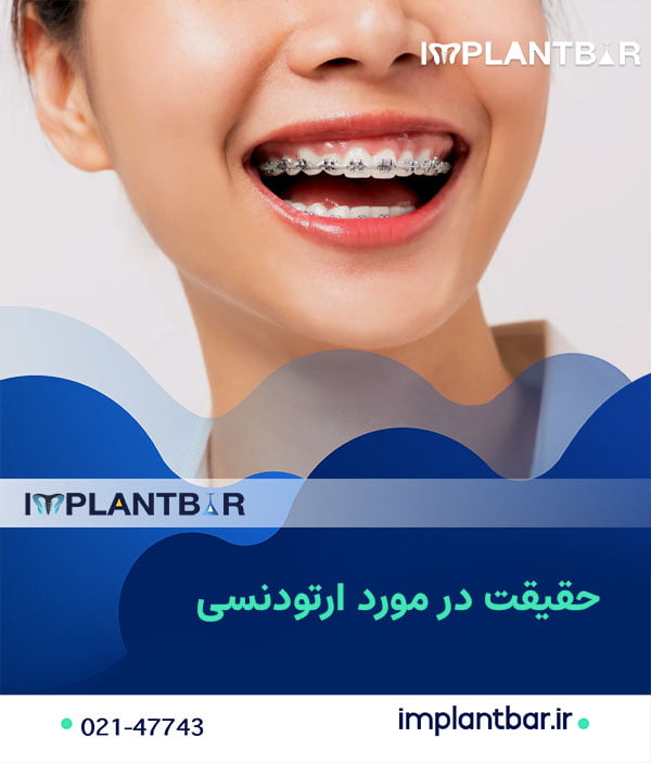 باورهای غلط ارتودنسی دندان 13