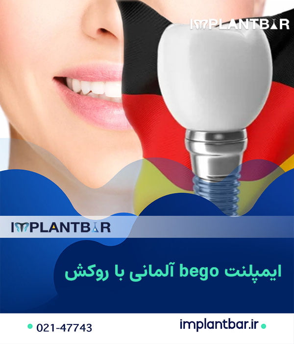 ایمپلنت bego آلمانی با روکش