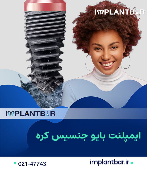 ایمپلنت بایو جنسیس کره بدون روکش
