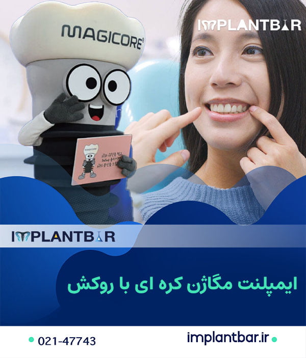 ایمپلنت مگاژن کره ای با روکش